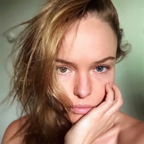 Latest High-Tech Professional Skin Treatments - Kate Bosworth