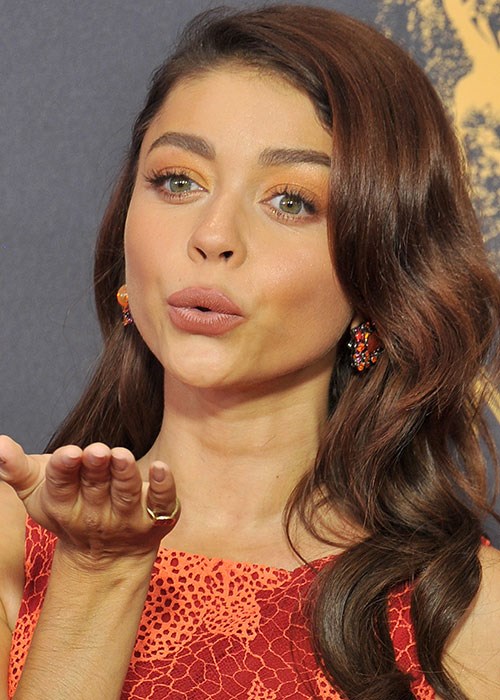 Sarah Hyland chapped lips