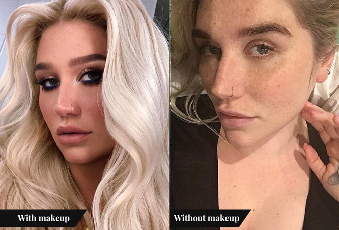 Celebs Without Makeup Photos - Kesha