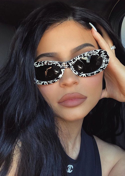 Kylie Jenner lip fillers