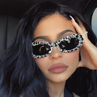 Kylie Jenner lip fillers