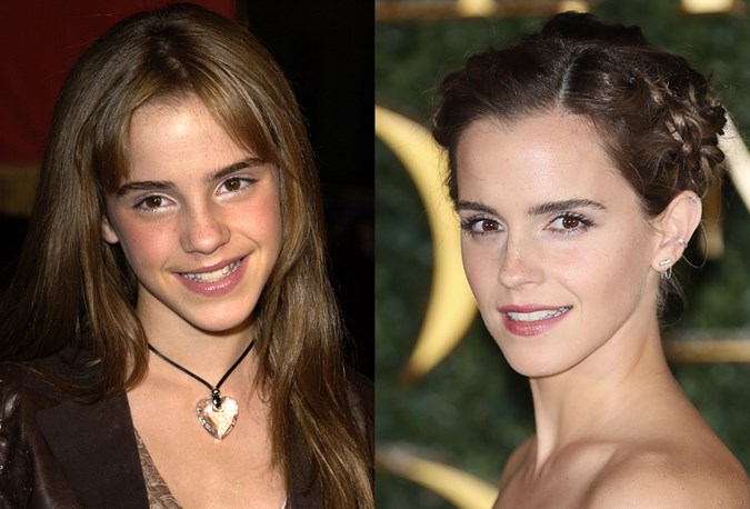 The Best Celebrity Beauty Throwback Photos From When They Were Teenagers