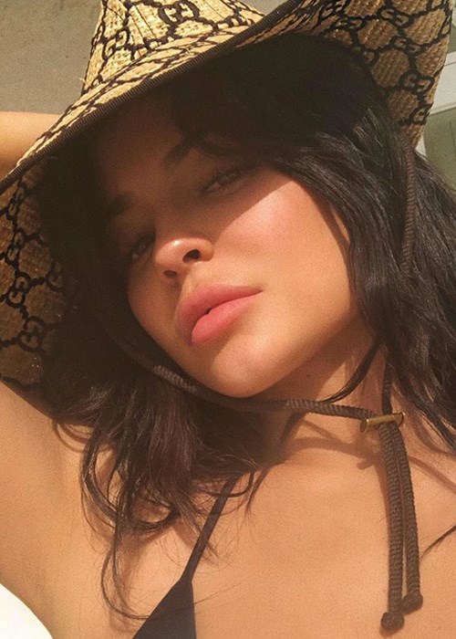 lip fillers Kylie Jenner