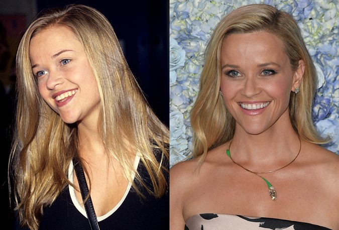 The Best Celebrity Beauty Throwback Photos From When They Were Teenagers